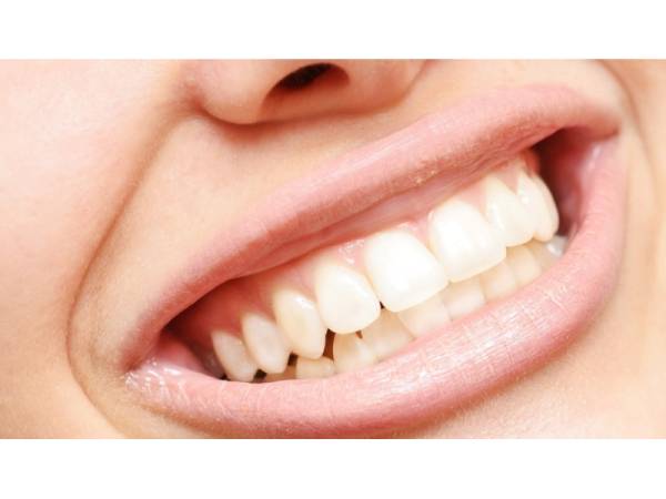 Expert Dental Restoration Services in Cambridge, ON – Bring Back Your Smile