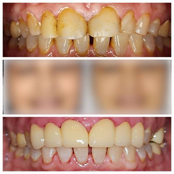 Best dental clinic in Delhi