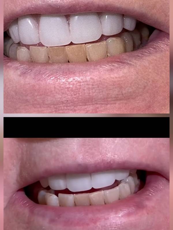 imgi_44_259dfb_c533081e8c3146328da10a911d89f12e~mv2