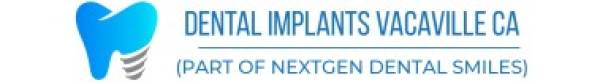 dental implants vacaville ca logo white